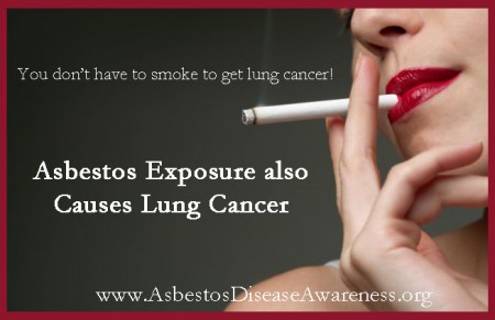Asbestos Exposure also Causes Lung Cancer